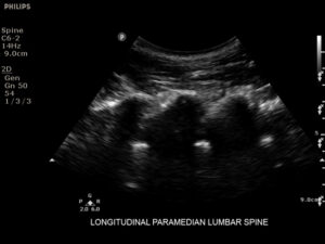 Aparat USG Philips Sparq- zdjęcie kliniczne