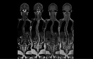 rezonans magnetyczny - zdjęcia kliniczne