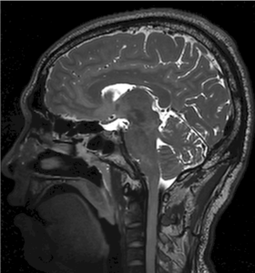 zdjęcie kliniczne - rezonans magnetyczny