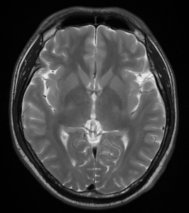 zdjęcie kliniczne - rezonans magnetyczny