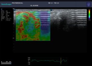 zdjęcie kliniczne SonoScape e2